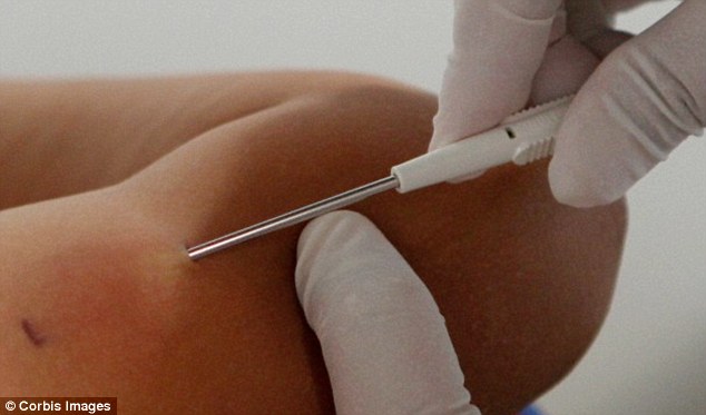 chip a bőr alá, masszázs helyett